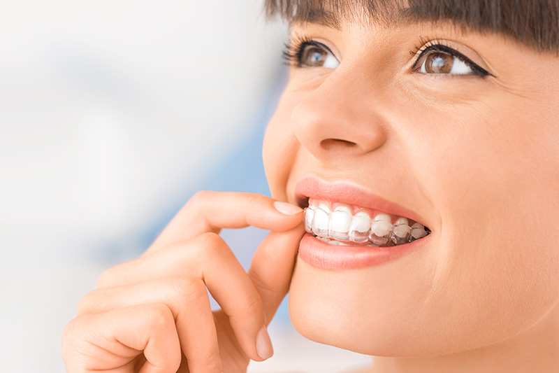 Invisalign in Exton