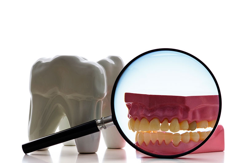 Root Canal in Exton